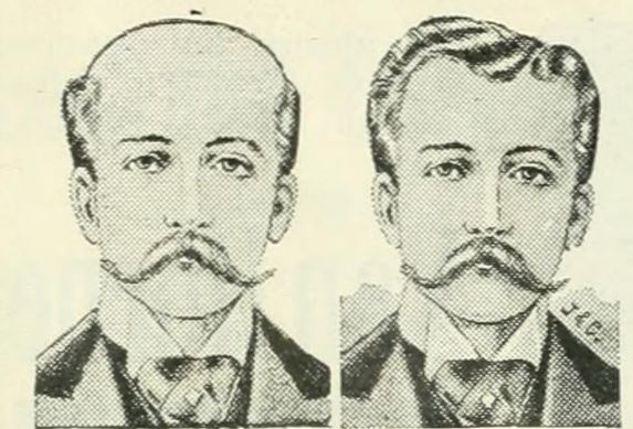 toupee before and after 1898 wig